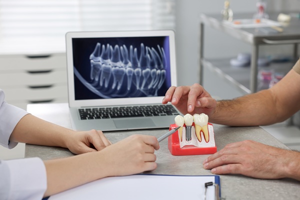 Dental Implant Recovery: What To Expect After The Procedure